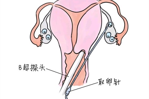 http://qingdao.vdtfzz.com/post/205.html|青岛供卵助孕